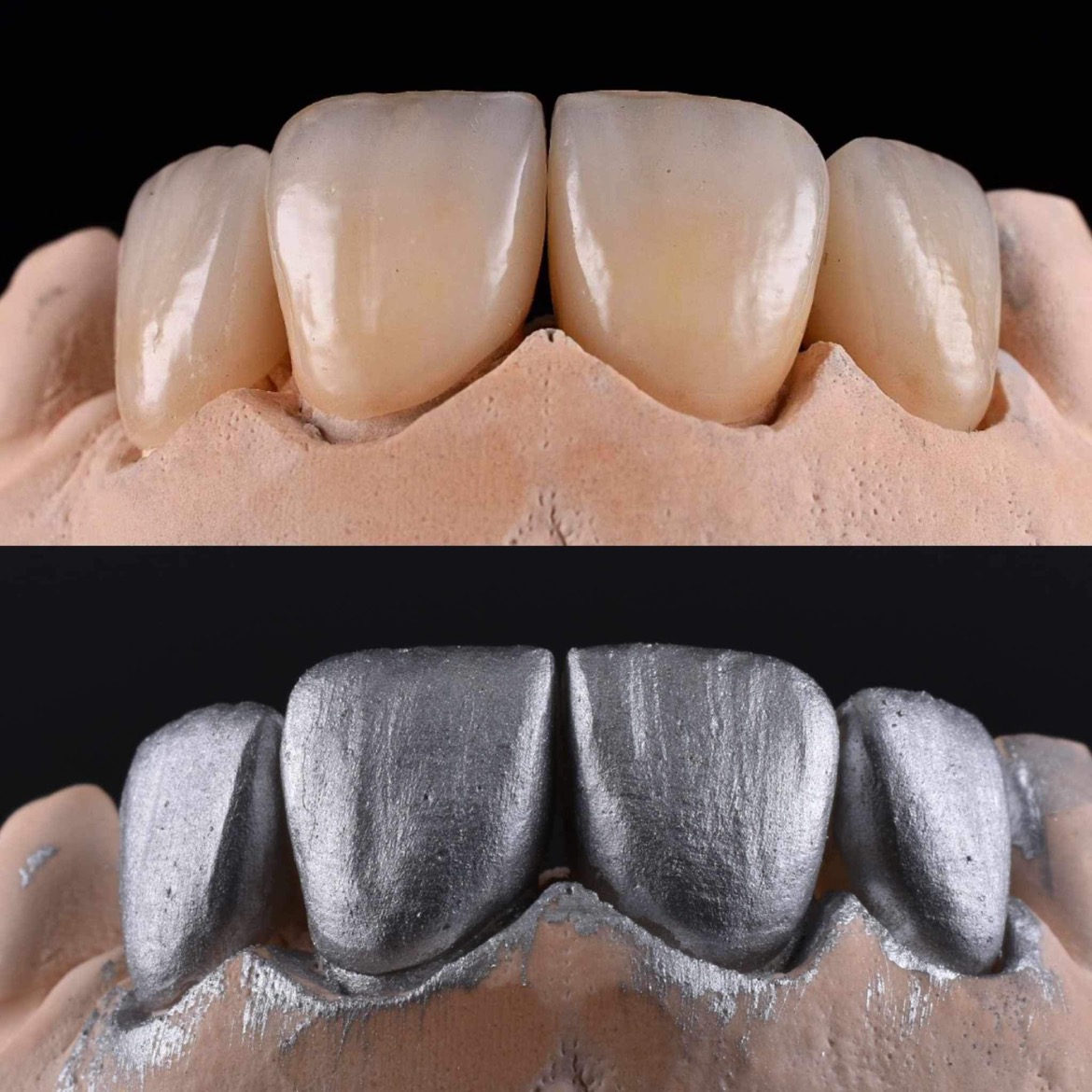 Dental Technician Career Spotlight on Ceramist, Bogdan Petre